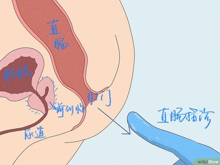 關(guān)于前列腺按摩的正確方法與部位，前列腺按摩的正確方法與部位詳解