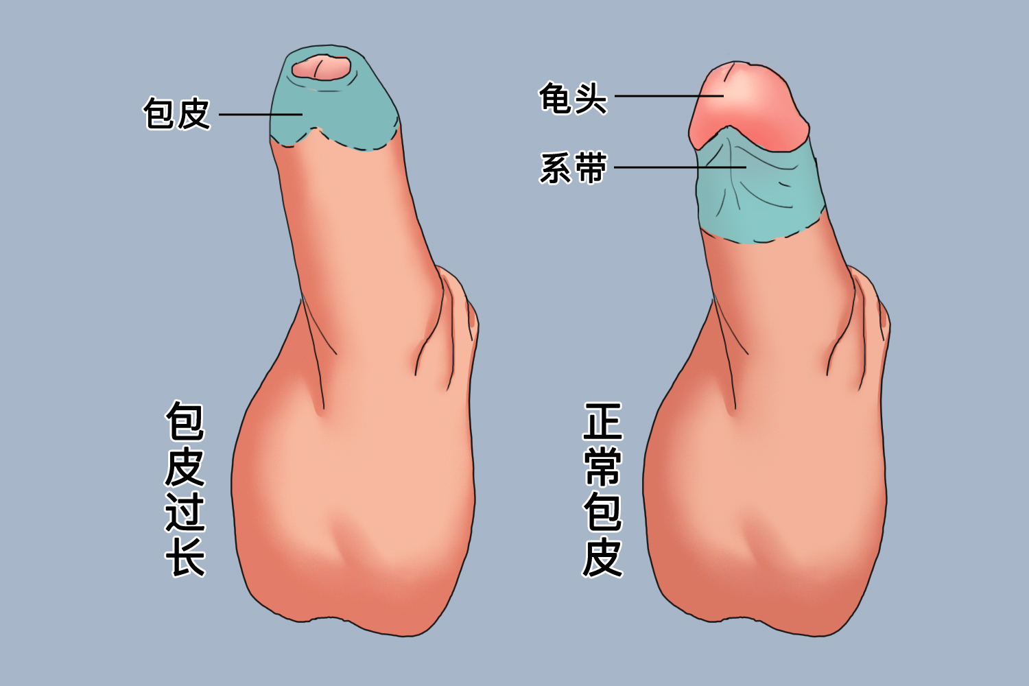 正常包皮的圖片及其相關(guān)知識(shí)科普，包皮圖片及其相關(guān)知識(shí)科普介紹