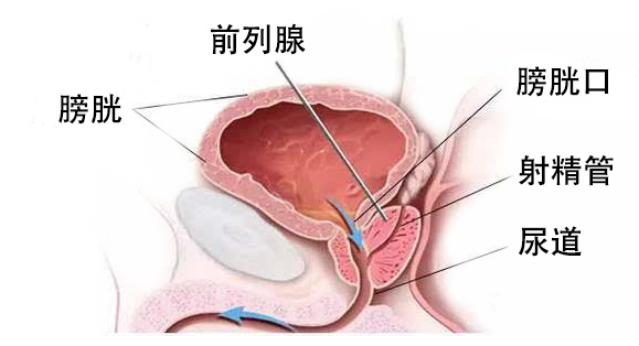 普樂安片治療前列腺炎的療程與效果，深度解析，普樂安片治療前列腺炎療程與效果深度解析，療程長短與治療效果一覽無余。