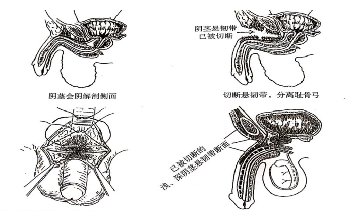 男性增大手術(shù)靠譜嗎？深度解析與探討，男性增大手術(shù)深度解析，可靠性與風(fēng)險探討